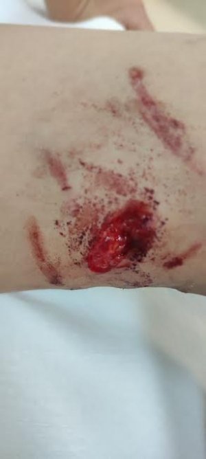 Başıboş sokak köpekleri çocuklara saldırdı