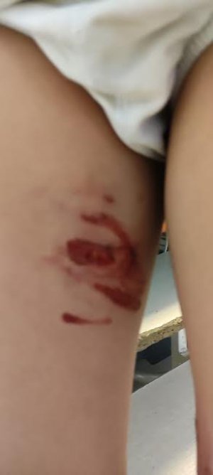 Başıboş sokak köpekleri çocuklara saldırdı