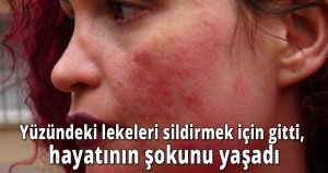 Yüzündeki lekeleri sildirmek için gitti, hayatının şokunu yaşadı