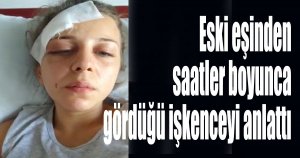  Eski eşinden saatler boyunca gördüğü işkenceyi anlattı