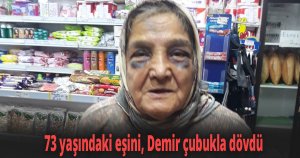  73 yaşındaki eşini, Demir çubukla dövdü
