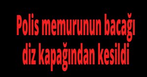 Polis memurunun bacağı diz kapağından kesildi