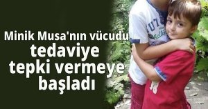  Minik Musa'nın vücudu tedaviye tepki vermeye başladı