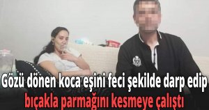 Gözü dönen koca eşini feci şekilde darp edip, bıçakla parmağını kesmeye çalıştı