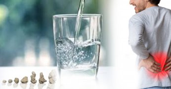 Az Su İçmek Böbrek Taşı Riskini Artırıyor