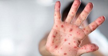 AKP Ülkeyi Yol Geçen Hanına Çevirdi!