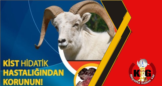 KİST HİDATİK HASTALIĞINA DİKKAT
