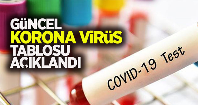 25 Temmuz koronavirüs tablosu 