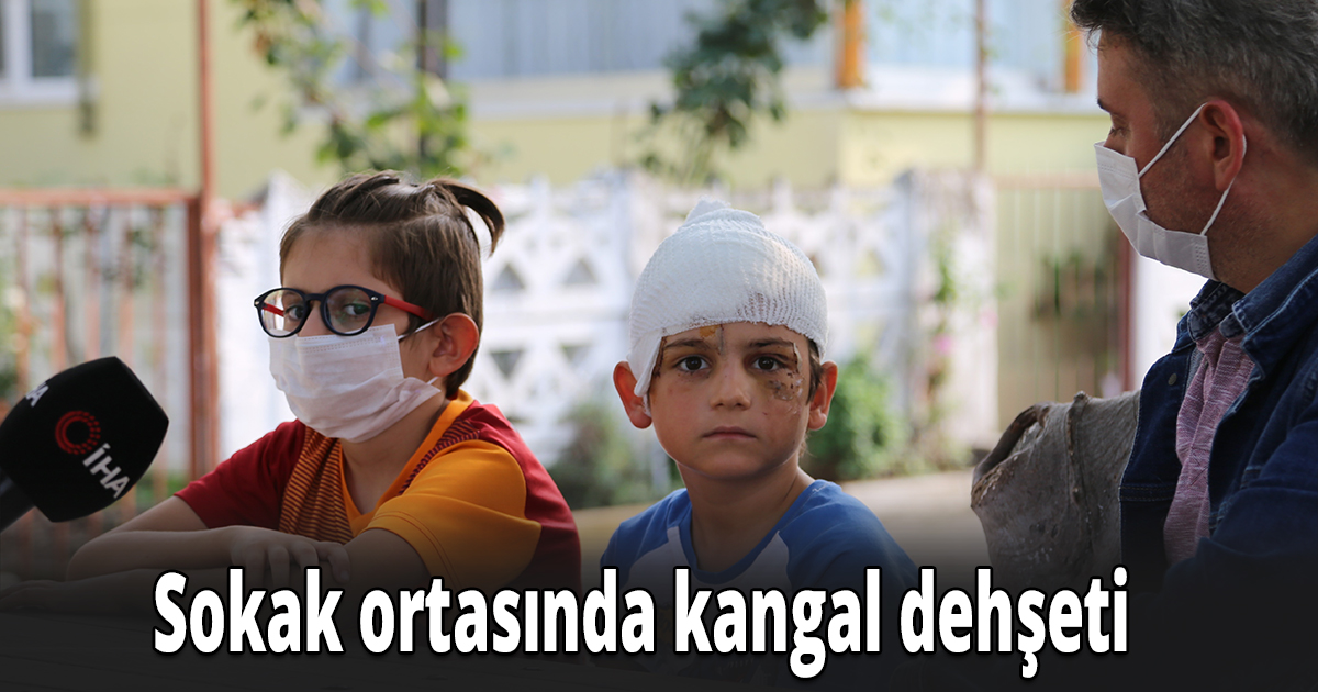 Sokak ortasında kangal dehşeti