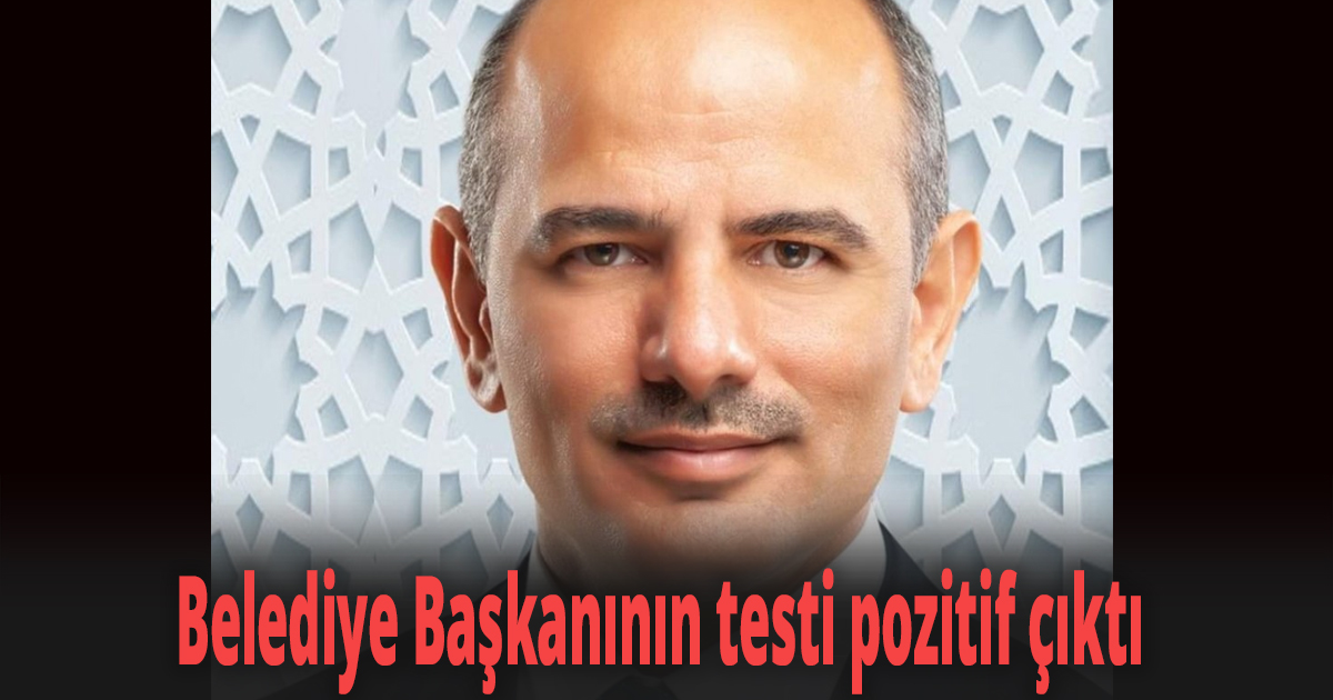 Kongre öncesi test yapıldı