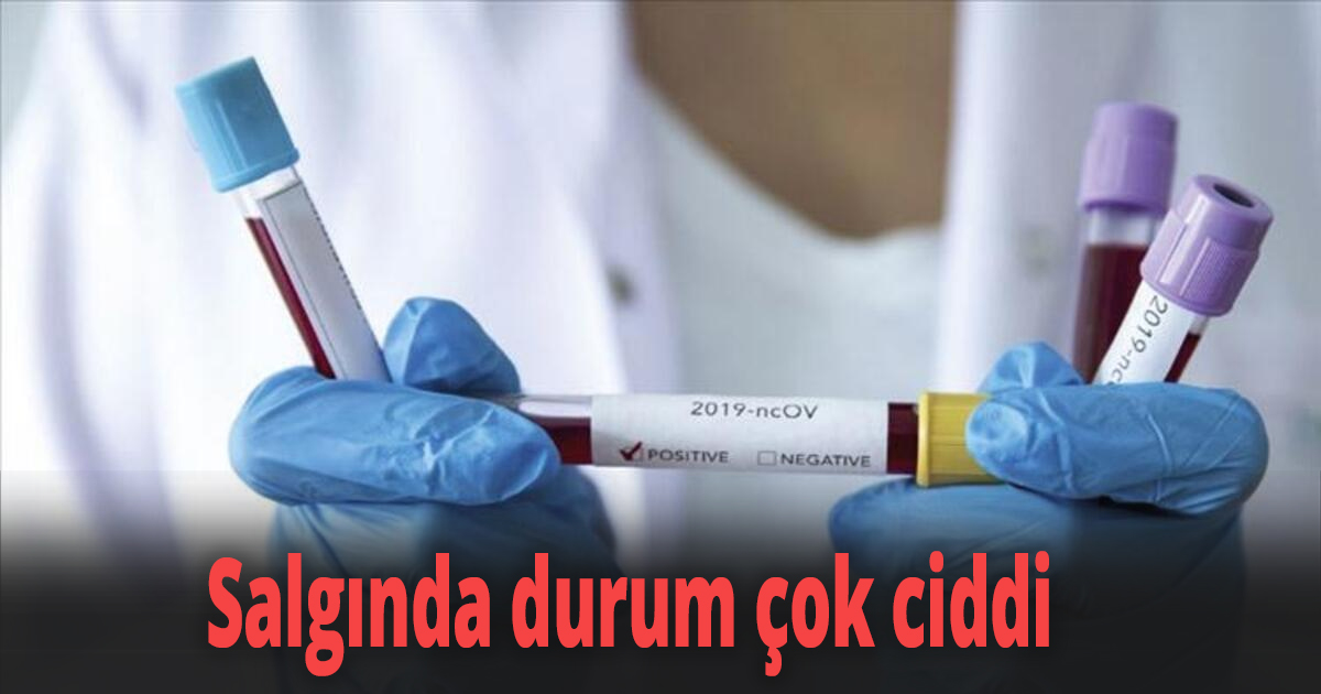 Salgında durum çok ciddi