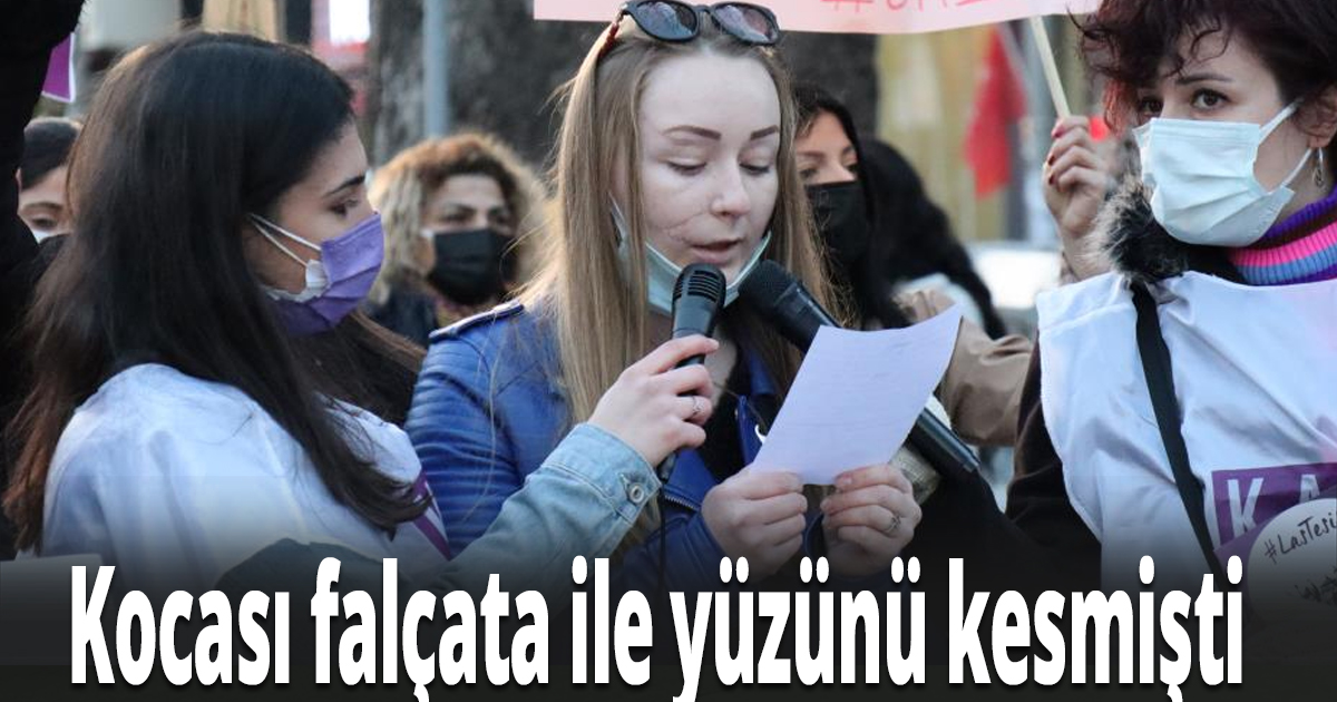 Kocası falçata ile yüzünü kesmişti