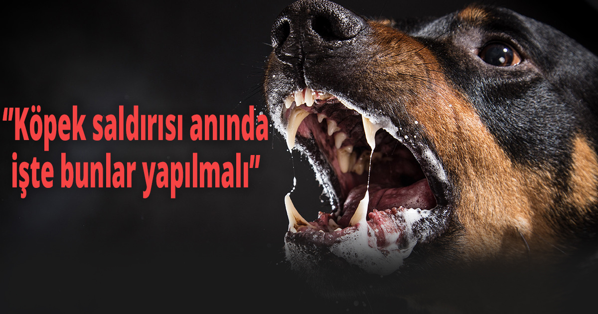 Köpek saldırısı anında işte bunlar yapılmalı