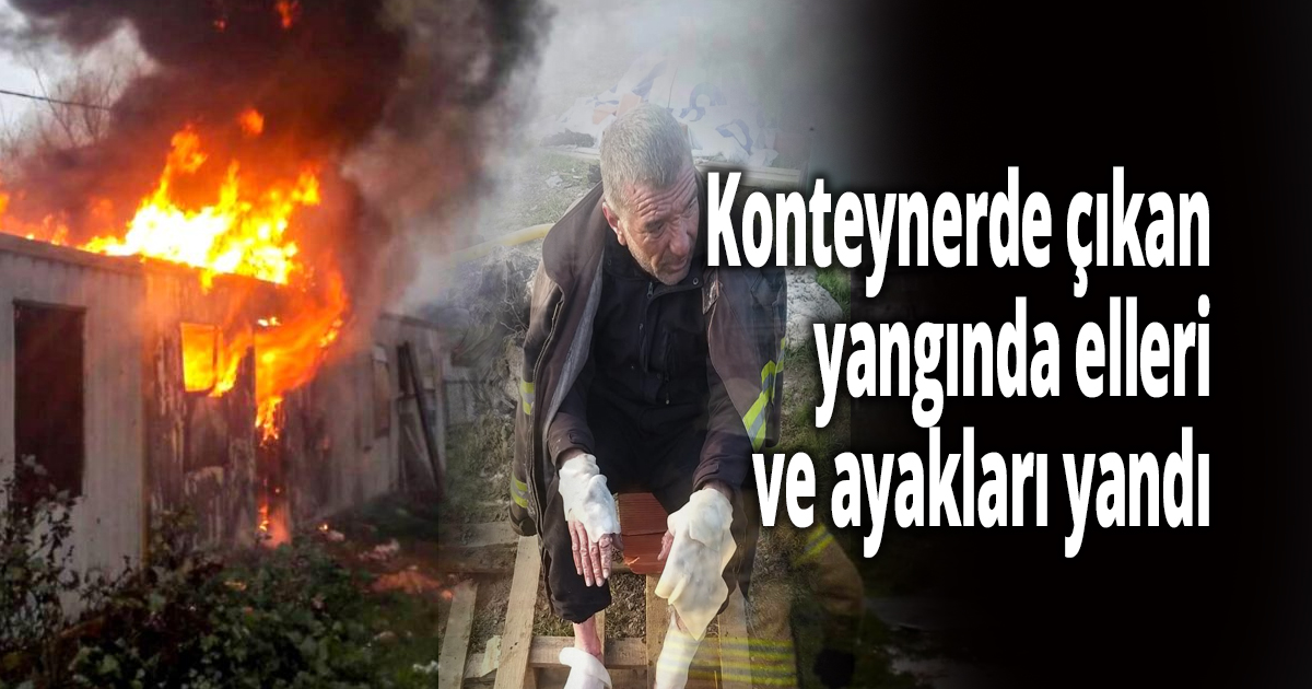 Konteynerde çıkan yangında elleri ve ayakları yandı