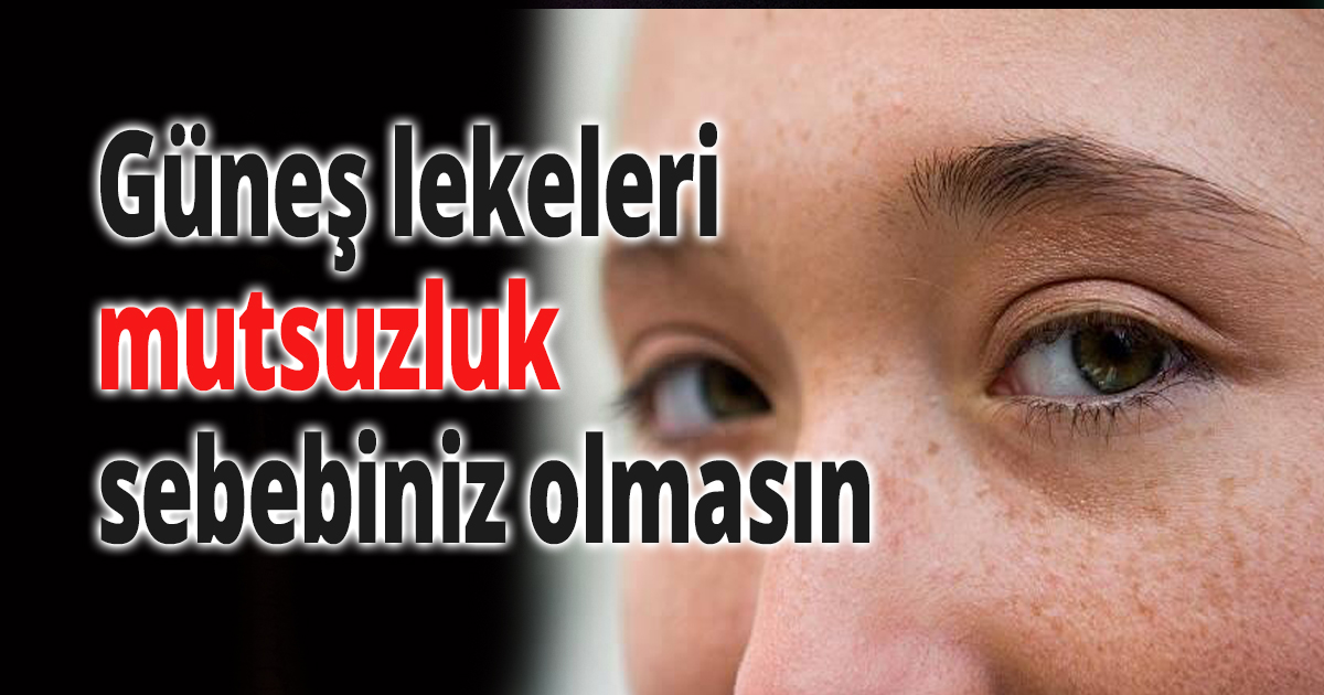 Güneş lekeleri mutsuzluk sebebiniz olmasın