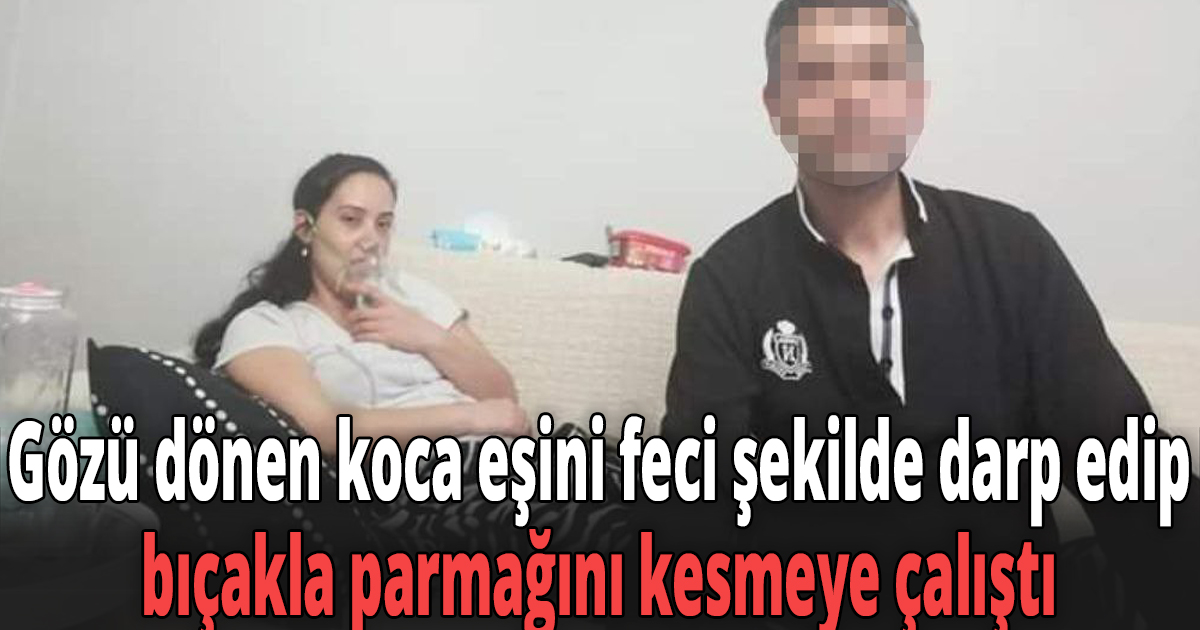 Gözü dönen koca eşini feci şekilde darp edip, bıçakla parmağını kesmeye çalıştı