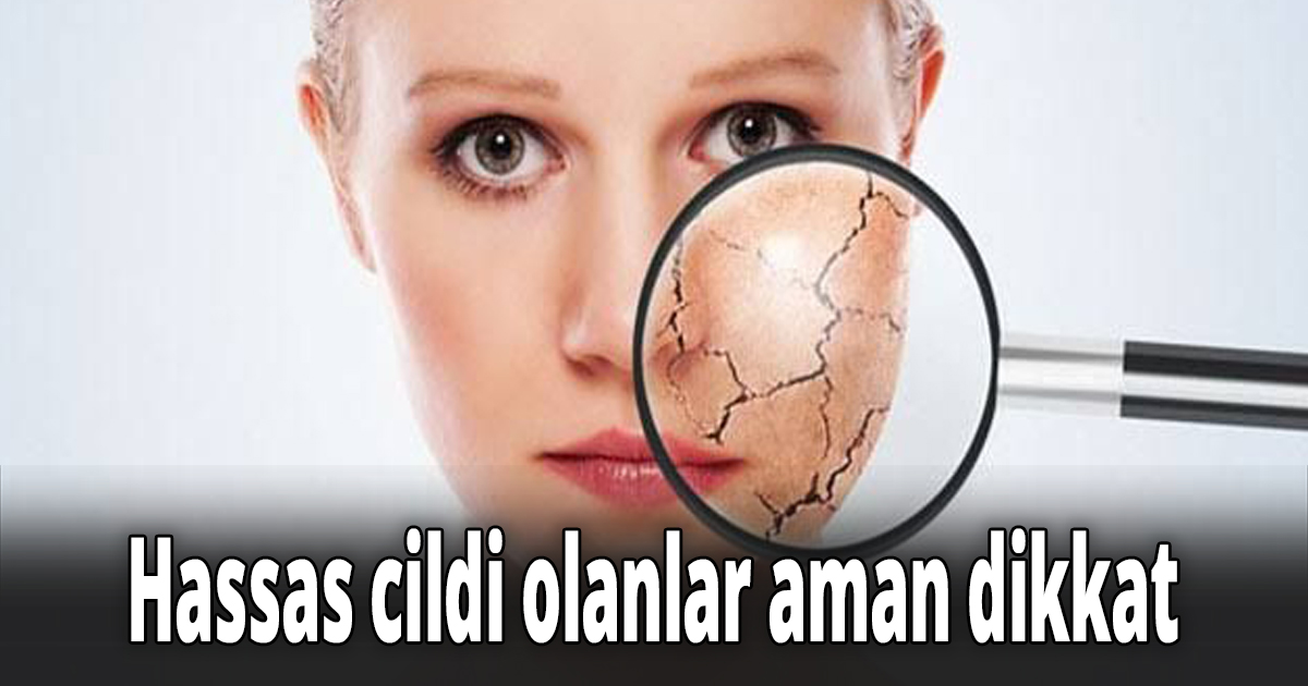 Hassas cildi olanlar aman dikkat