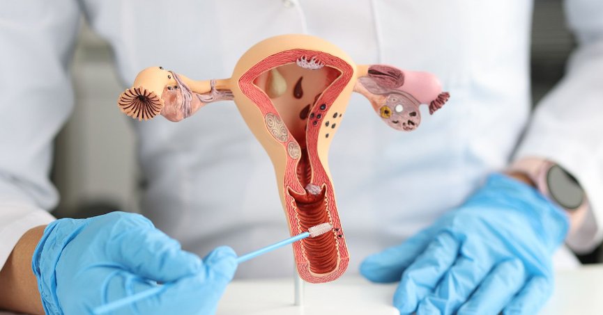 “RAHİM AĞZI KANSERİ ÖNLENEBİLİR”