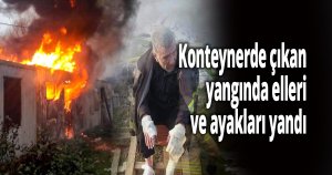 Konteynerde çıkan yangında elleri ve ayakları yandı
