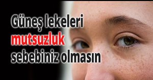 Güneş lekeleri mutsuzluk sebebiniz olmasın